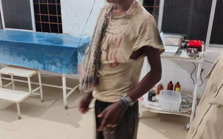 ଅଜଣା ଯୁବକ ଚୋରି ଉଦ୍ୟମ ବେଳେ ବସ୍ତି ବାସିନ୍ଦା ମାଡ଼ି ବସି ପୋଲିସ ଜିମାରେ ଦେଲେ।