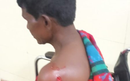 ଭାଲୁ ଆକ୍ରମଣରେ ବୃଦ୍ଧ ଆହତ ।