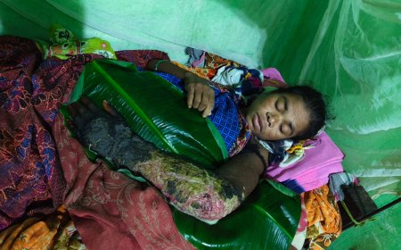 ଯନ୍ତ୍ରଣାରେ ଛଟପଟ ରାଧା,ଚିକିତ୍ସା ପାଇଁ ଅର୍ଥ ବାଧକ।