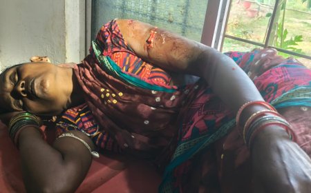 ଭାଲୁ ଆକ୍ରମଣରେ ମହିଳା ଗୁରୁତର ।